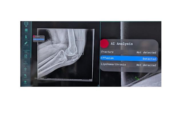 Singapore healthy aging technology